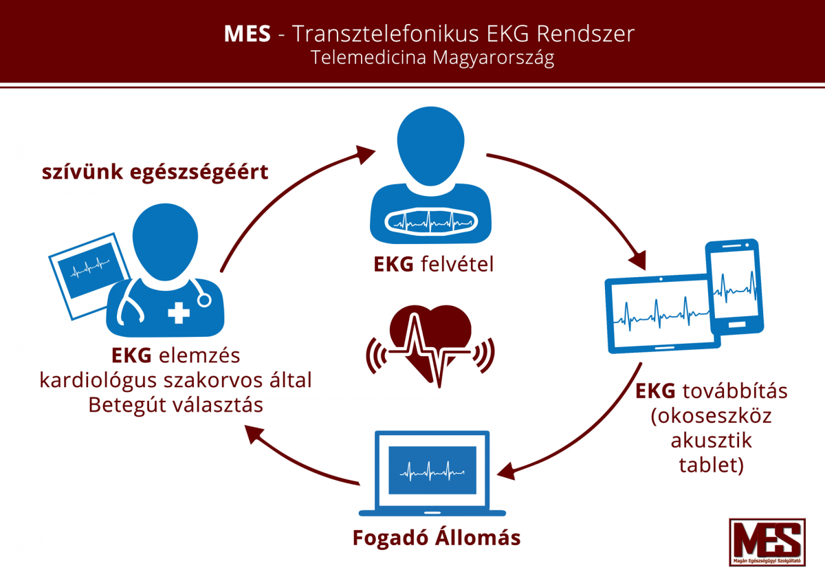 Transztelefonikus EKG 